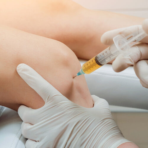 doctor performing IV Prolotherapy injection into knee